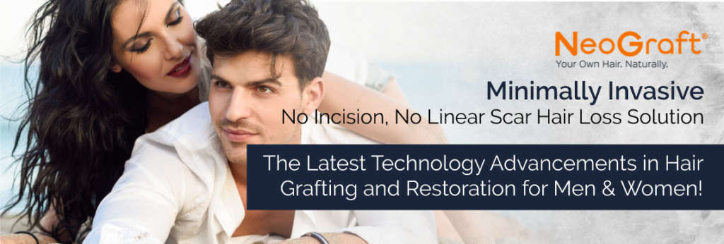 Female Hair Restoration and hair loss Solutions -Neograft Hair Restoration