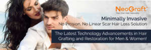 Female Hair Loss Solutions -Neograft Hair Restoration