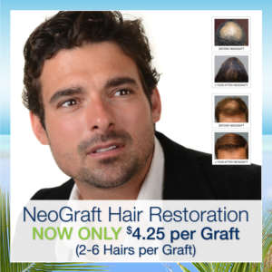 Neograft cost at Hair Restoration Savannah is now only 4.25