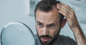 Common Causes of Hair Loss by Dr. FInger_ Hair Restoration Savannah has solutions for Alopecia (3)