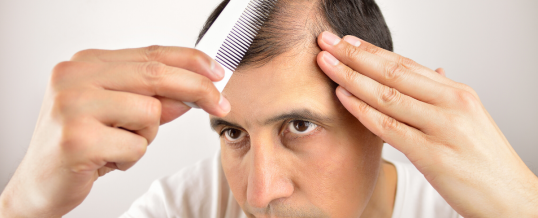 Millions of Men and Women Suffer from Hair Loss!