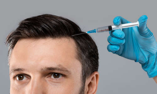 Mesotherapy for hair. Young man getting injections in head Mesotherapy for hair. Closeup of young man getting injections in head, grey panorama background. Millennial man having mesotherapy session at beauty salon, therapist in protective glove with syringe