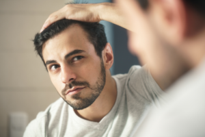 Hair loss valuation in Savannah Georgia at hair restoration Savannah (1200 x 800 px)