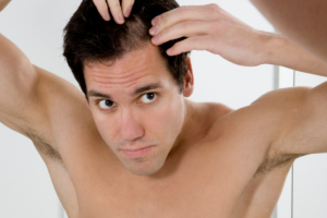 Man looking at his hair thinning - Hair Rejuvenation with Hair Restoration Savannah
