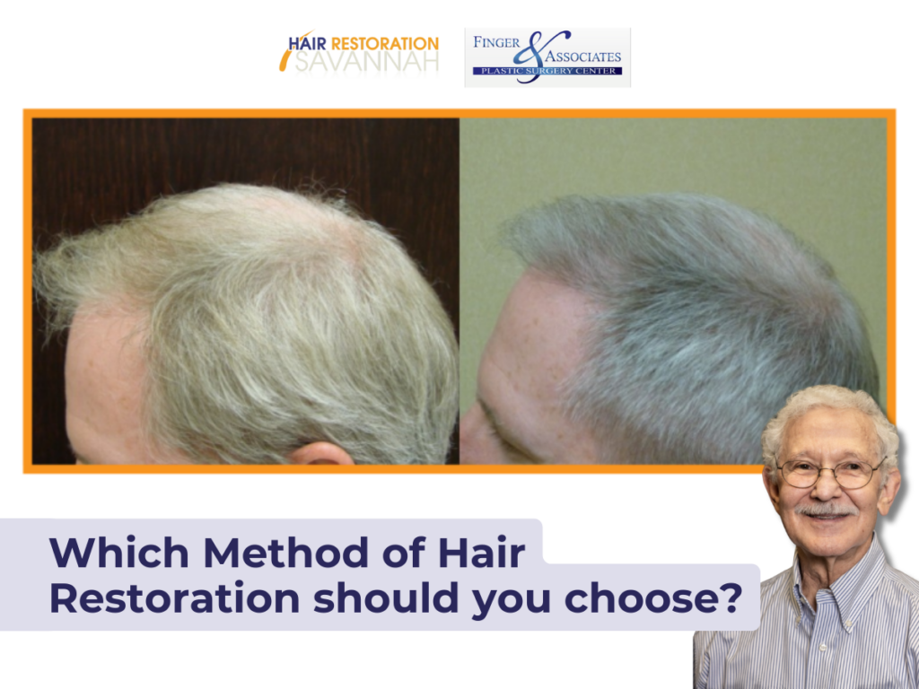 Hair Restoration Savannah- Which Method of Hair Restoration should you choose Hair Restoration Savannah- Which Method of Hair Restoration should you choose.