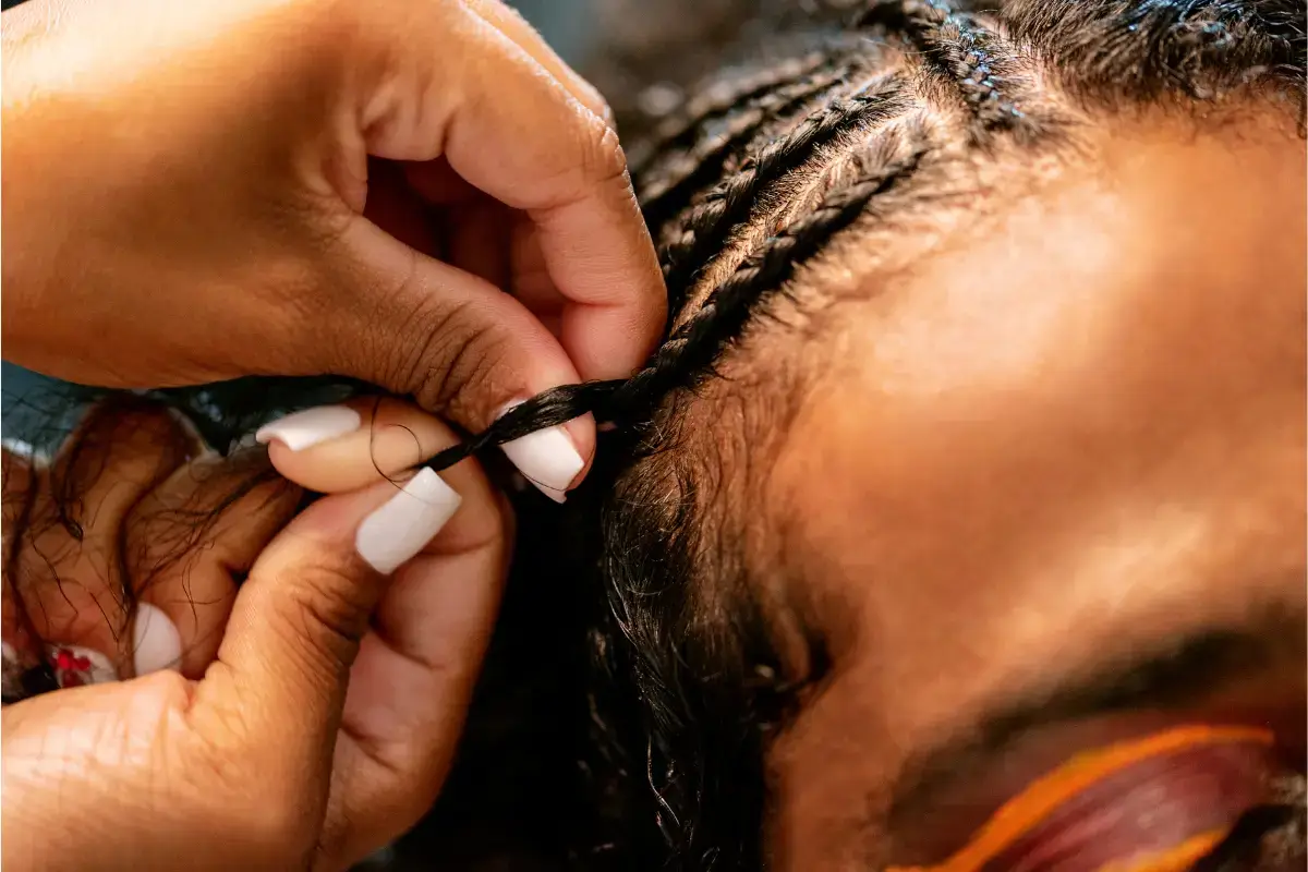 Traction Alopecia Causes